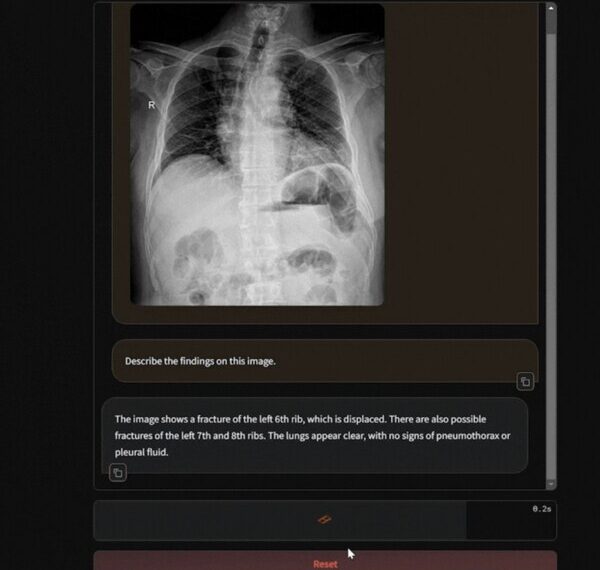 Introducing Harrison.rad.1, the latest frontier in radiology-specific foundational models.